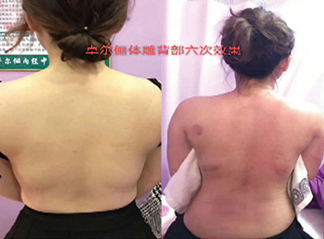 養(yǎng)生理療客戶